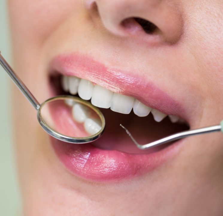 Dentist examining a female patient with tools at dental clinic